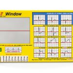 R-CAT Yellow EKG Card 3.25 x 6.75 in with Reversible Window-0