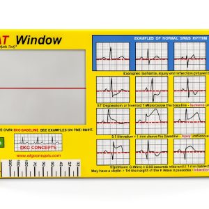 R-CAT Yellow EKG Card 3.25 x 6.75 in with Reversible Window-0